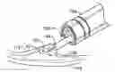 Fig. 01 - Endoscopic tool with suction for facilitating injection of a fluid into a submucosal layer of tissue
