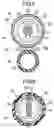 Fig. 06 - Medical device and treatment method