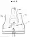 Fig. 06 - Instrument for fracture alignment and plate compression