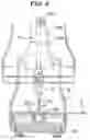 Fig. 09 - Instrument for fracture alignment and plate compression