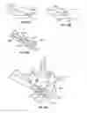 Fig. 11 - Devices and methods for treating bone