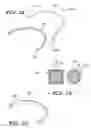 Fig. 02 - Orthodontic wire alignment system and method
