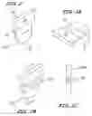 Fig. 04 - Orthodontic wire alignment system and method