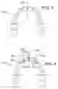 Fig. 07 - Orthodontic wire alignment system and method