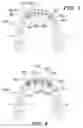 Fig. 09 - Orthodontic wire alignment system and method
