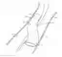 Fig. 01 - Methods for puncturing an expandable member to confirm advancement into a body passage