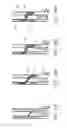 Fig. 22 - Methods for puncturing an expandable member to confirm advancement into a body passage