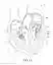 Fig. 02 - Prosthetic incision device and methods thereof
