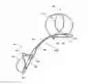 Fig. 01 - Tissue shaping device
