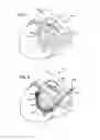 Fig. 02 - Tissue shaping device