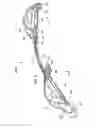 Fig. 06 - Tissue shaping device