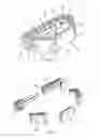 Fig. 02 - Expandable intervertebral implant and methods of use thereof