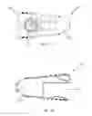 Fig. 08 - Expandable intervertebral implant and methods of use thereof