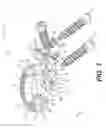 Fig. 02 - Interbody standalone intervertebral implant