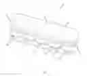 Fig. 02 - TOOL AND METHOD FOR COMPRESSING A STENTED PROSTHESIS