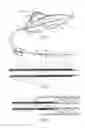 Fig. 02 - Pull wire for vascular intervention device delivery system