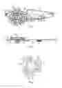 Fig. 03 - Pull wire for vascular intervention device delivery system