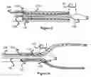 Fig. 03 - Pushable implant delivery system