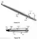 Fig. 07 - Pushable implant delivery system