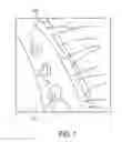 Fig. 02 - Therapeutic handheld devices for disorders