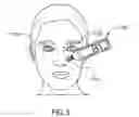 Fig. 06 - Treatment methods using handheld devices for disorders