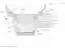 Fig. 01 - Vacuum loss detection during laser eye surgery