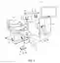 Fig. 02 - Vacuum loss detection during laser eye surgery