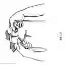 Fig. 28 - WOUND CLOSURE DEVICES