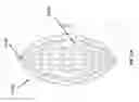 Fig. 33 - WOUND CLOSURE DEVICES