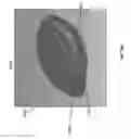 Fig. 35 - WOUND CLOSURE DEVICES