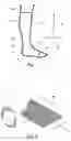Fig. 02 - Tension adjusting and stabilization system and method