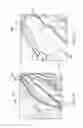 Fig. 16 - Patient support surface control, end of life indication, and x-ray cassette sleeve