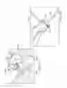 Fig. 67 - Patient support surface control, end of life indication, and x-ray cassette sleeve