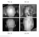 Fig. 02 - Methods for treating hair loss disorders