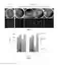 Fig. 02 - Inflammasome inhibition for the treatment of Parkinson's disease, Alzheimer's disease and multiple sclerosis