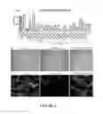 Fig. 02 - TREATMENT FOR PROGRESSIVE MULTIPLE SCLEROSIS