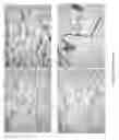 Fig. 08 - Extracellular matrix material