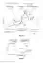 Fig. 28 - Fluid preparation and treatment devices methods and systems