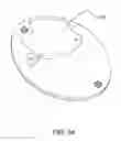 Fig. 109 - Device to determine volume of fluid dispensed