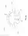 Fig. 130 - Device to determine volume of fluid dispensed