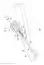 Fig. 02 - Subcutaneous anchor device for securing a catheter