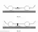 Fig. 02 - Braking system