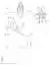 Fig. 06 - Structure for coupling an upper portion of an instrument panel with a defroster
