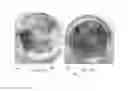 Fig. 35 - Systems and methods for conditioning electrolyzed water