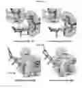 Fig. 15 - Structures and mechanism for the design of highly potent glucocorticoids