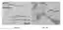 Fig. 06 - Treatment of kerogen in subterranean formations