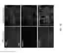 Fig. 04 - Methods, compositions, and kits for producing beige adipocytes and treating metabolic disorders