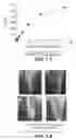 Fig. 06 - NOVEL METALLOPROTEASES