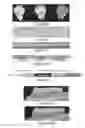 Fig. 05 - MicroRNA-200 based approaches for modulating bone formation inhibition and bone regeneration