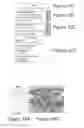 Fig. 08 - MicroRNA-200 based approaches for modulating bone formation inhibition and bone regeneration